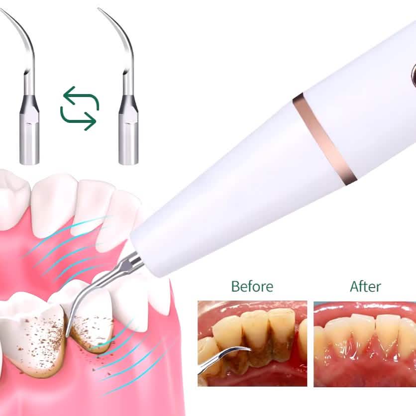 Advanced Electric Teeth Cleaning Tool