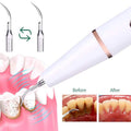 Advanced Electric Teeth Cleaning Tool